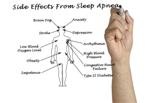 writing side effects sleep apnea